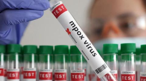 MPOX